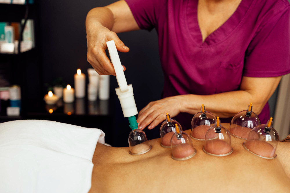 cupping2